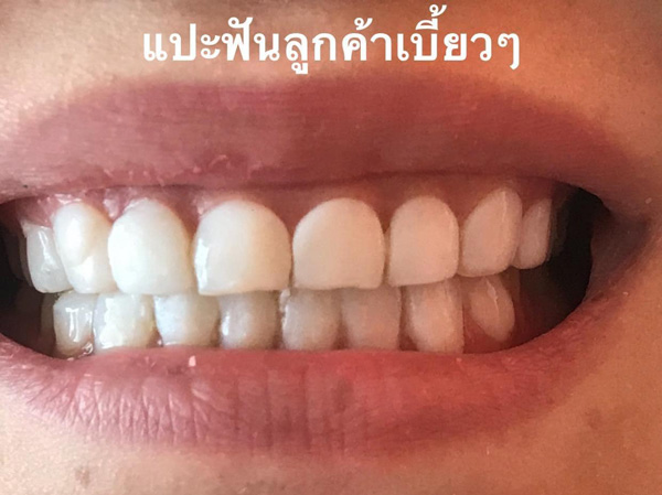 แฉหมอฟัน แฉหมอฟัน