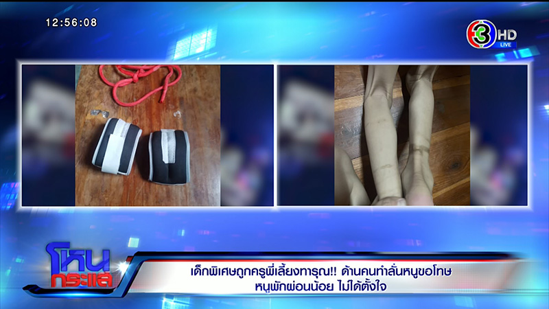 เด็กพิเศษถูกครูทารุณจับผูกขา เด็กพิเศษถูกครูทารุณจับผูกขา
