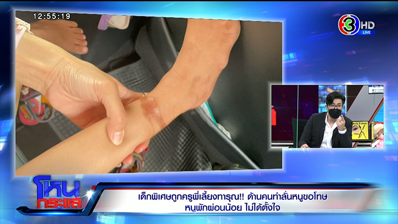 เด็กพิเศษถูกครูทารุณจับผูกขา เด็กพิเศษถูกครูทารุณจับผูกขา