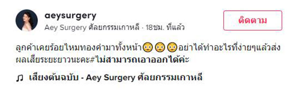 โพสต์ โพสต์