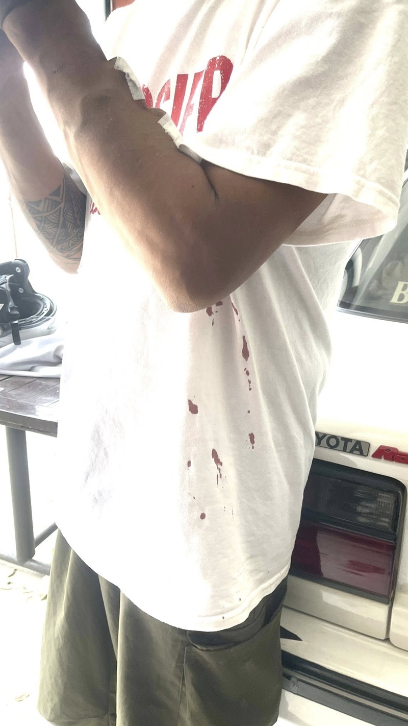 ผู้ป่วยฟอกไต ร้องเจอหัวหน้าพยาบาลเหวี่ยง