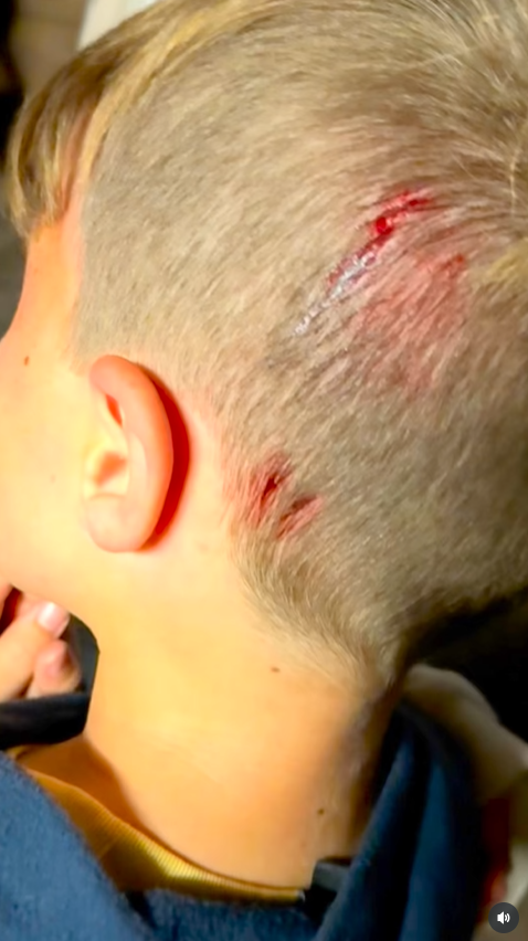 เล่นกับงู งูกัดหัว