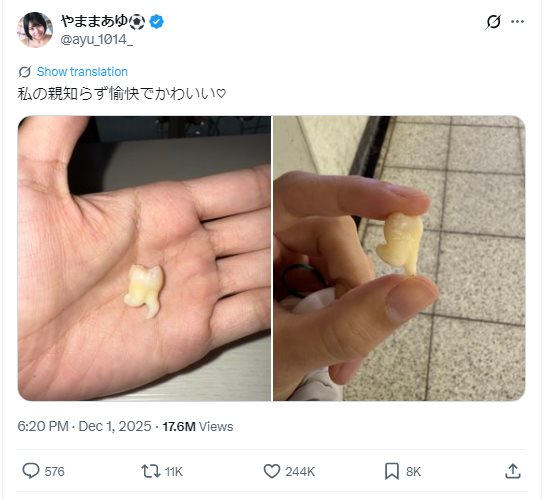 ภาพฟันคุดสาวญี่ปุ่น กลายเป็นไวรัล 17 ล้าน 