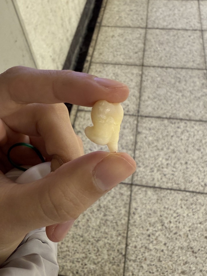 ภาพฟันคุดสาวญี่ปุ่น กลายเป็นไวรัล 17 ล้าน