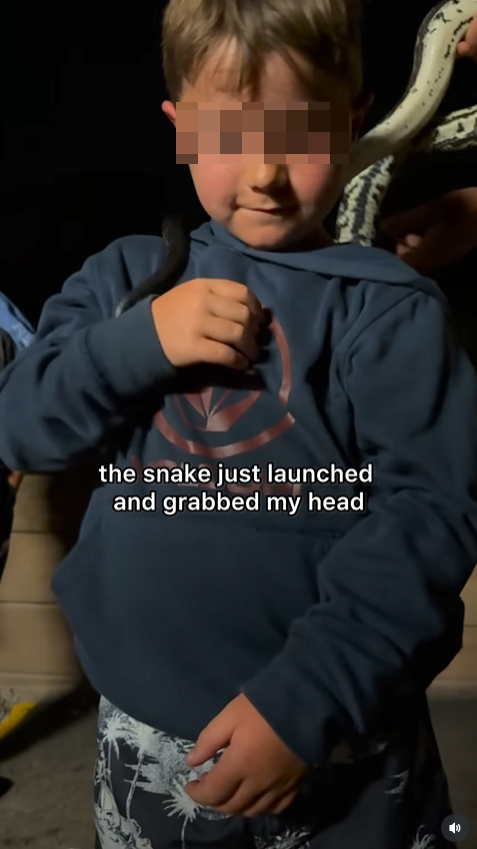 เล่นกับงู งูกัดหัว