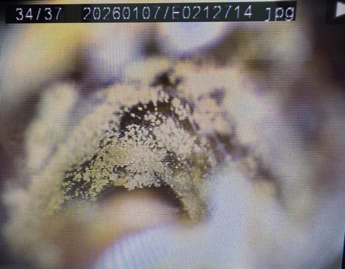 เตือนใจคนชอบแคะหู