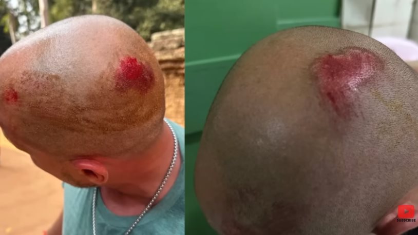 นักท่องเที่ยวต่างชาติ ถูกทำร้ายในนครวัด