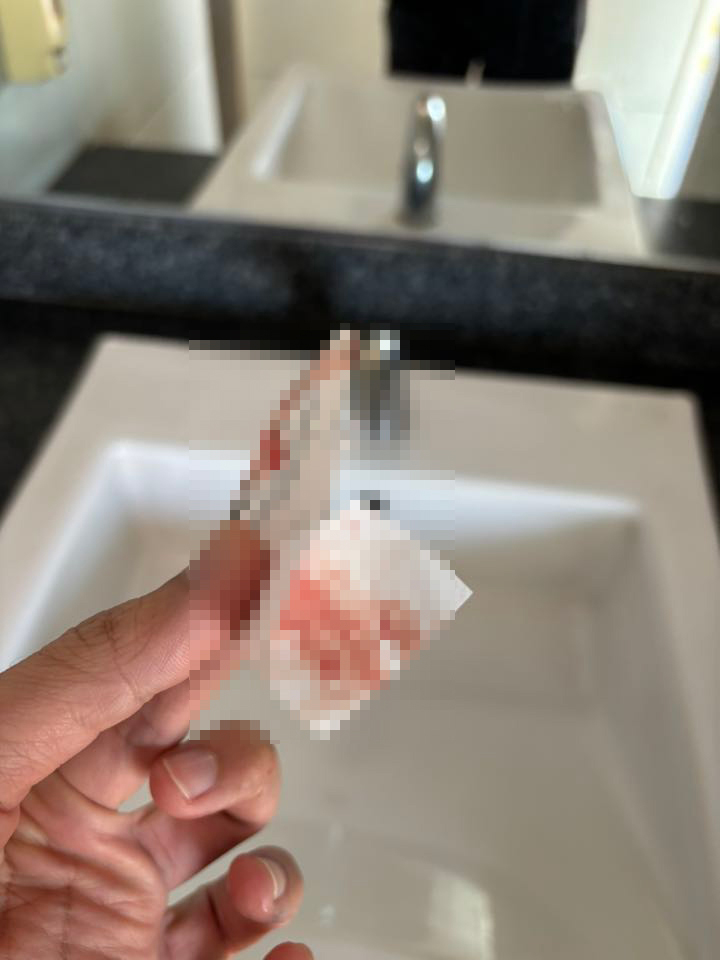 เลือดเปื้อนบน MRT