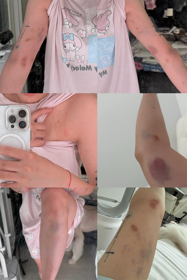 ยูทูบเบอร์ ถูกทำร้าย