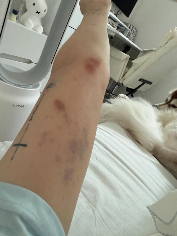 ยูทูบเบอร์ ถูกทำร้าย