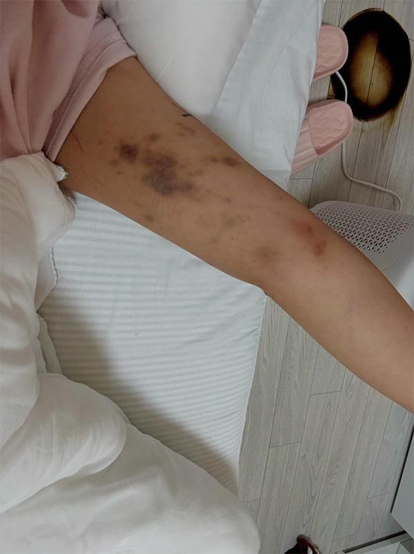 ยูทูบเบอร์ ถูกทำร้าย