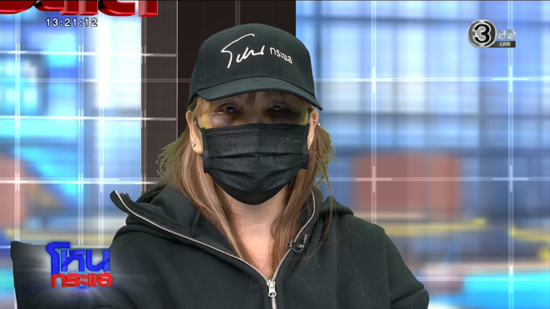 สาวร้องถูกอดีตแฟนทำร้ายร่างกาย สาวร้องถูกอดีตแฟนทำร้ายร่างกาย