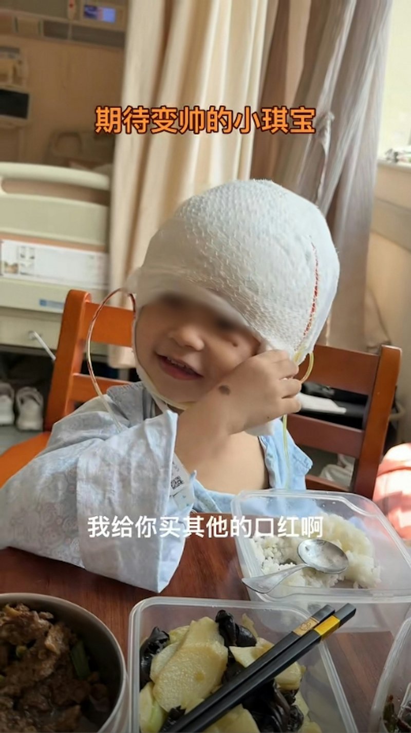 เด็ก 3 ขวบ มีไฝยักษ์ ถูกล้อเหมือนมิกกี้เมาส์ ตอนนี้ยิ้มได้ หลังผ่าตัดแล้ว