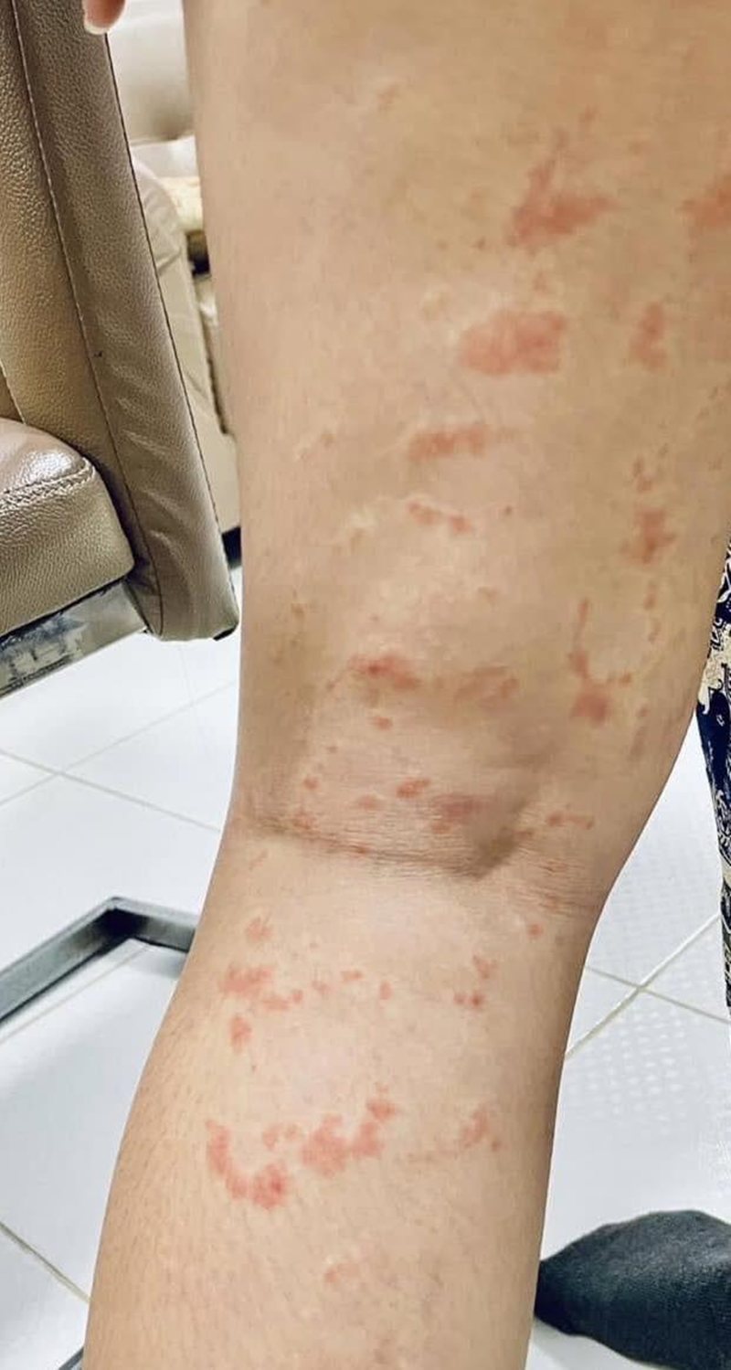 คนวิเคราะห์ ทำไม ซิฟิลิส กับ HIV ระบาดหนักมาก ที่มหาสารคาม คนวิเคราะห์ ทำไม ซิฟิลิส กับ HIV ระบาดหนักมาก ที่มหาสารคาม