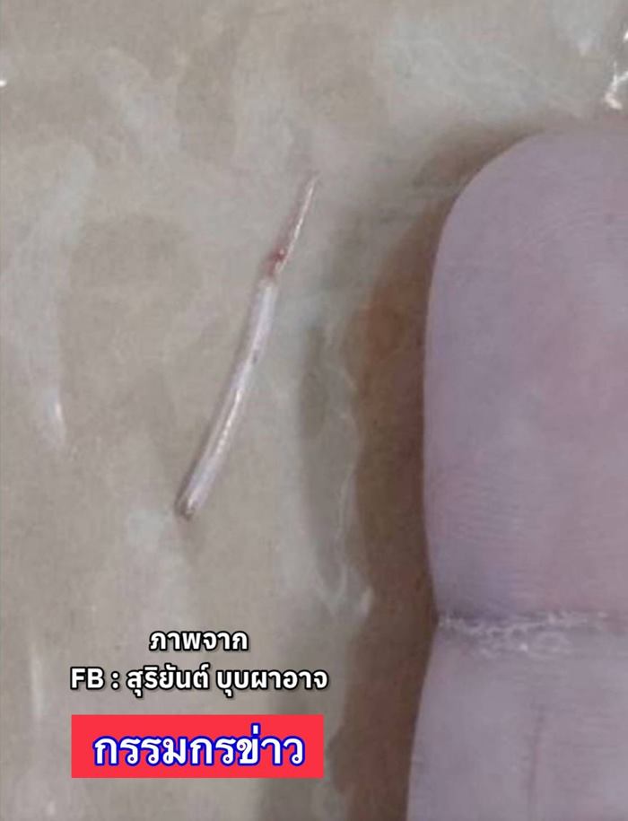 ก้างติดคอ