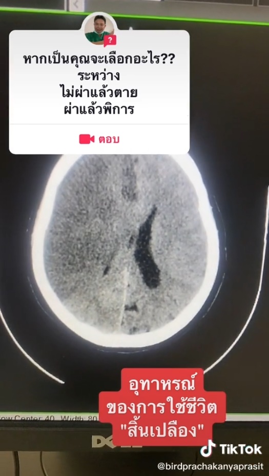 ควรเลือกทางไหน 