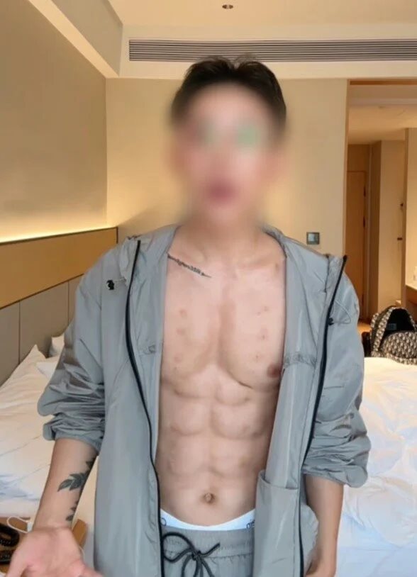 หนุ่มอยากมีกล้ามท้อง ยอมจ่าย 18 ล้าน สร้างกล้ามทางลัด แค่ซิกแพคมันน้อยไป