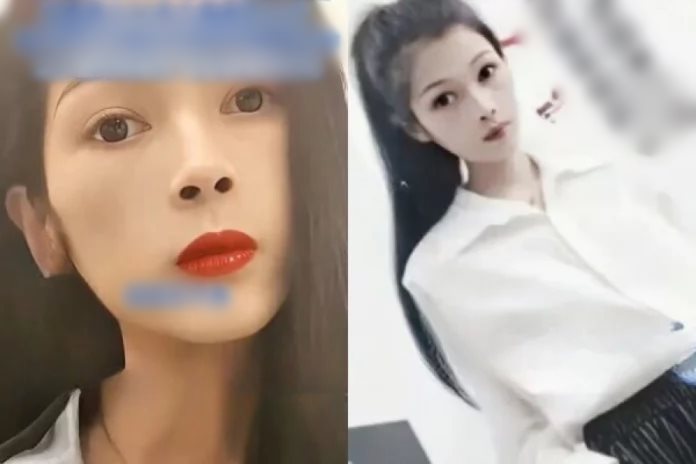 สาวหนักแค่ 17 กก. กระเพาะอาหารฝ่อ 