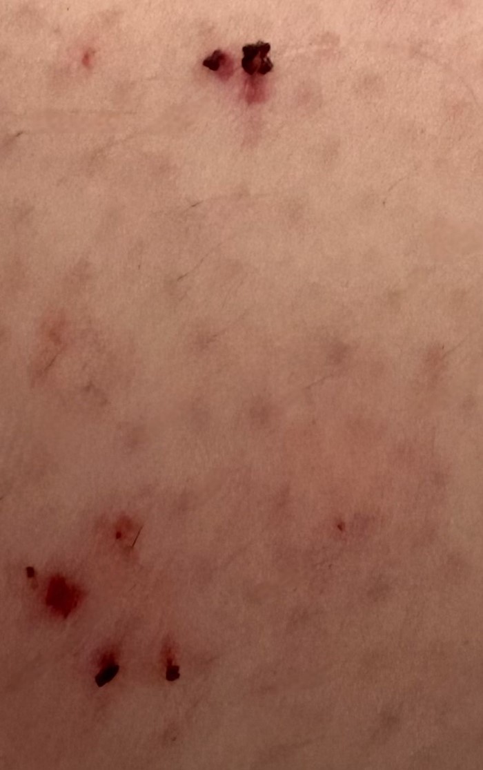 งูติดรองเท้า