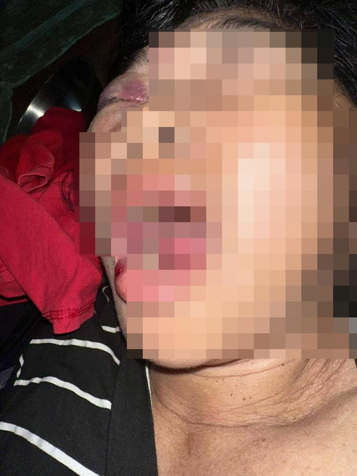 ถ้าอยากได้ ไปฟ้องเอา