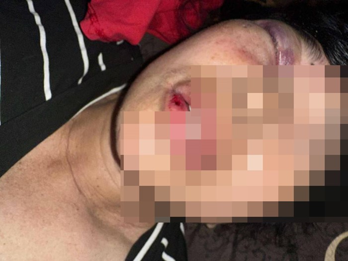 ถ้าอยากได้ ไปฟ้องเอา