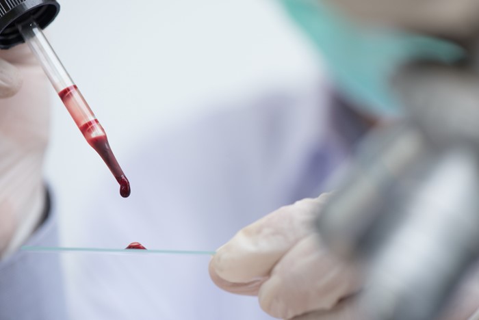 เลือดหนืด เลือดหนืด