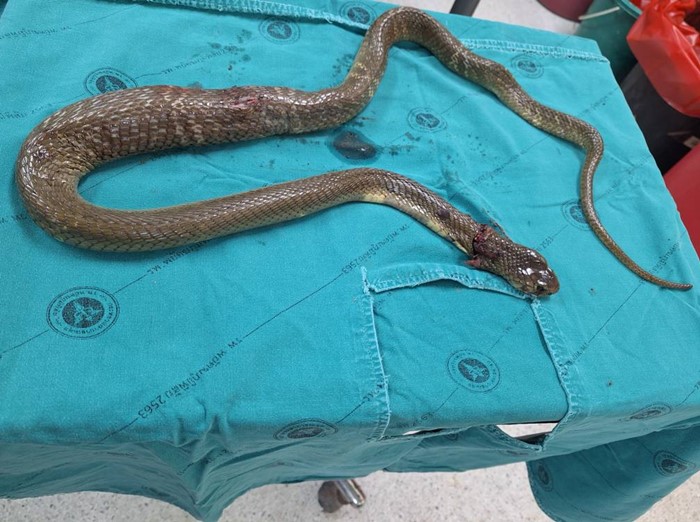 ชายถูกงูพ่นพิษเข้าตา 2 ข้าง