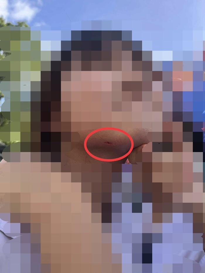  เด็ก 15 หลุดจากเครื่องเล่นซีเวฟ ถูกเหวี่ยงหวิดตกพื้น