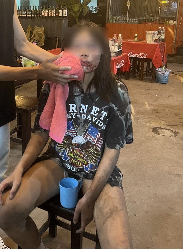 ทำร้ายร่างกาย