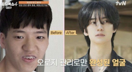  ปฏิเสธศัลยกรรม แต่ได้หน้าแบบไอดอล   