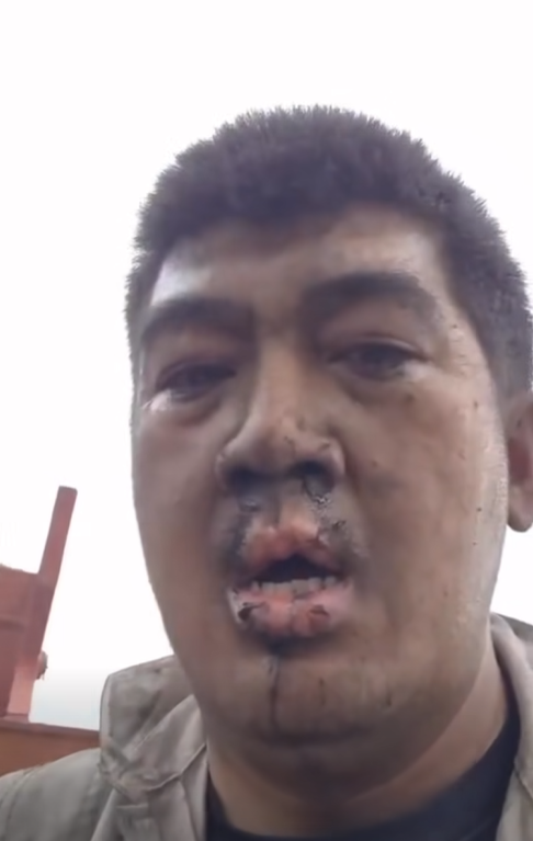 เรือไทยถูกยิง