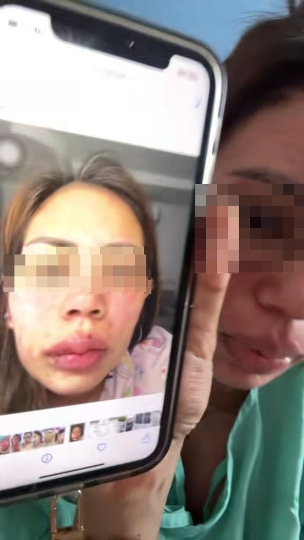  ผื่นขึ้น อย่ามองข้าม 