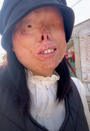 จากหน้าพัง วาดหน้าใหม่จนปัง