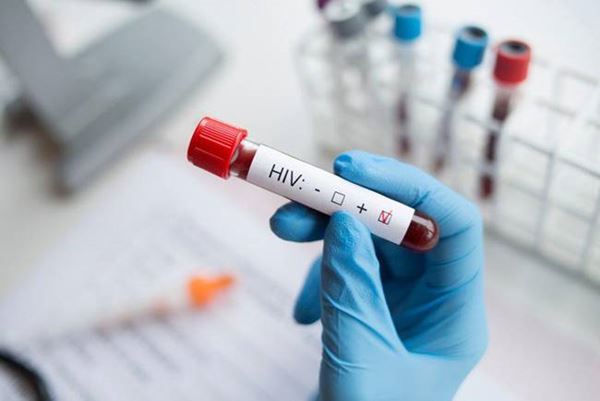 5 จังหวัดน่ากังวล โรคติดต่อทางเพศ - ยอด HIV พุ่ง 5 จังหวัดน่ากังวล โรคติดต่อทางเพศ - ยอด HIV พุ่ง