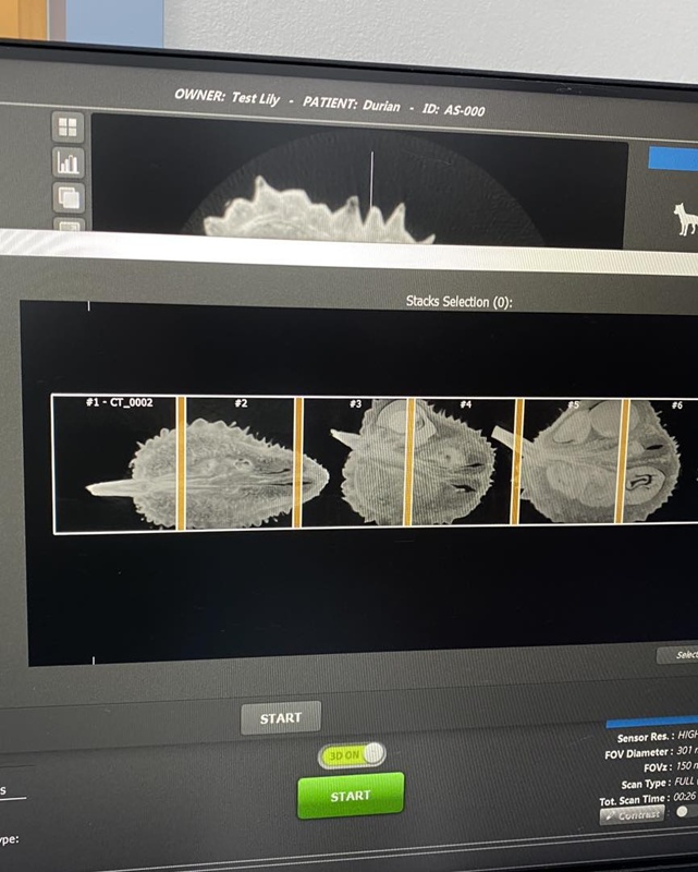 CT Scan น้องทุเรียน