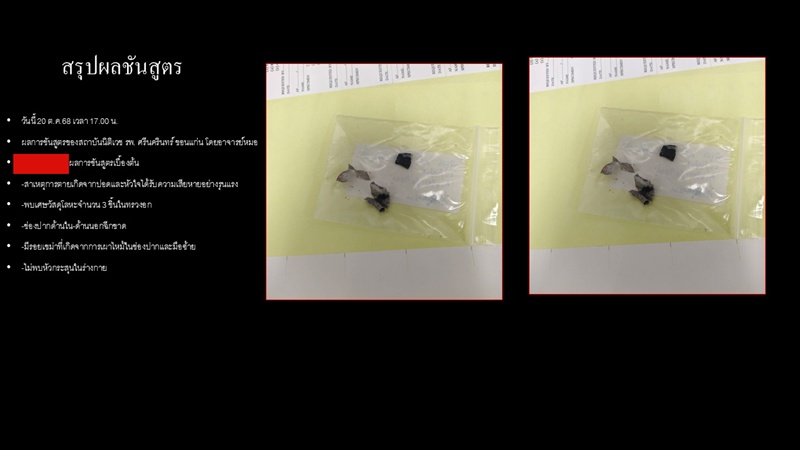 บุหรี่ไฟฟ้าระเบิด