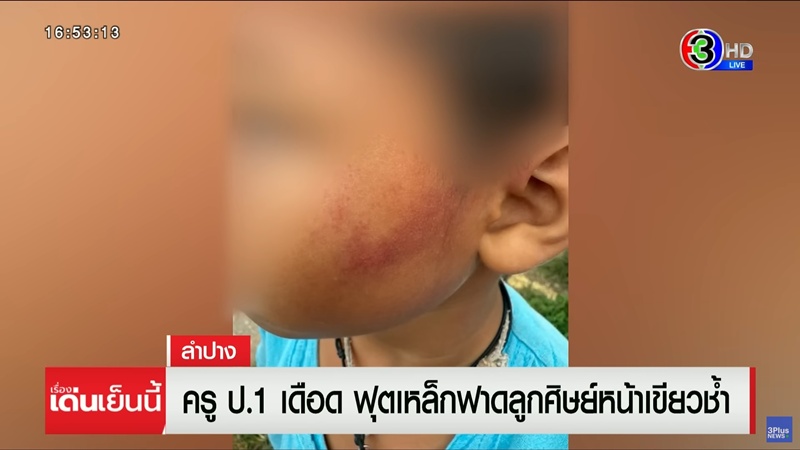 ครูตีเด็กขอขมากับแม่เด็ก