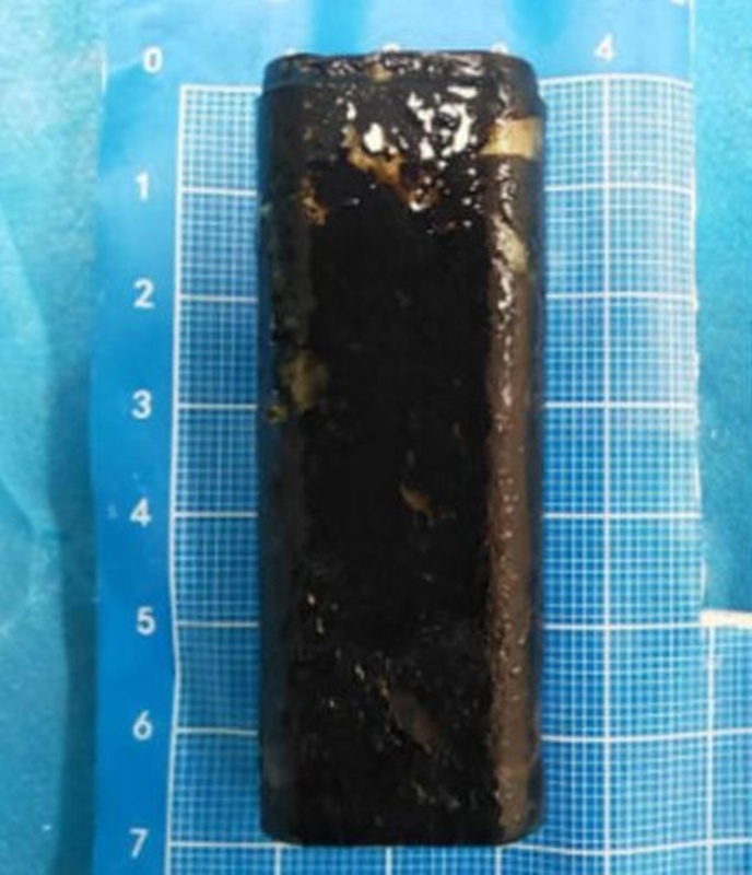 หมอพบวัตถุปริศนาสีดำในท้องคนไข้