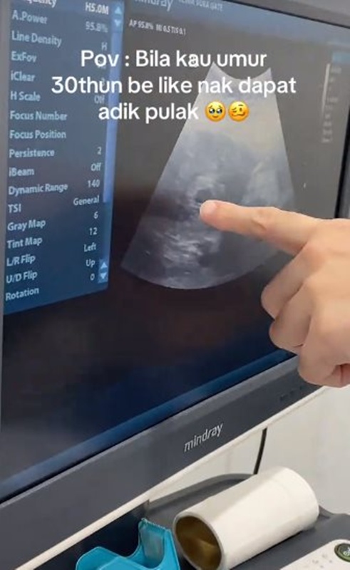 แม่วัย 51 ตั้งครรภ์ไม่คาดคิด