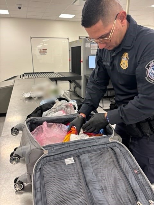 จนท. สนามบินช็อก ตรวจกระเป๋าเจอกระโหลก