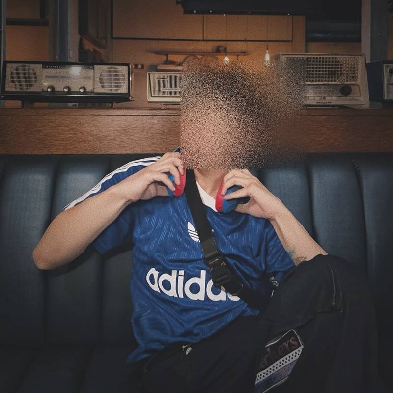 ตัดกระเพาะ