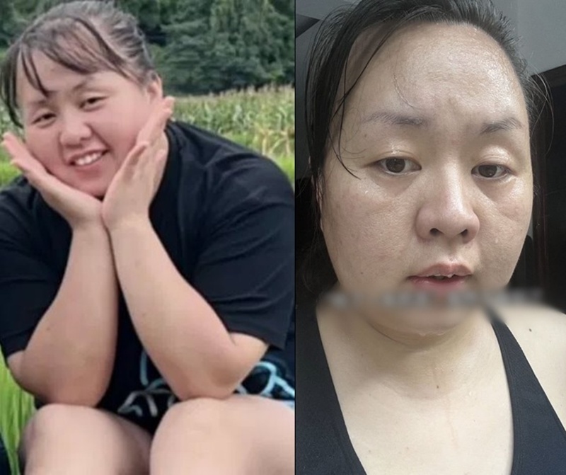 ลดน้ำหนัก ลดน้ำหนัก