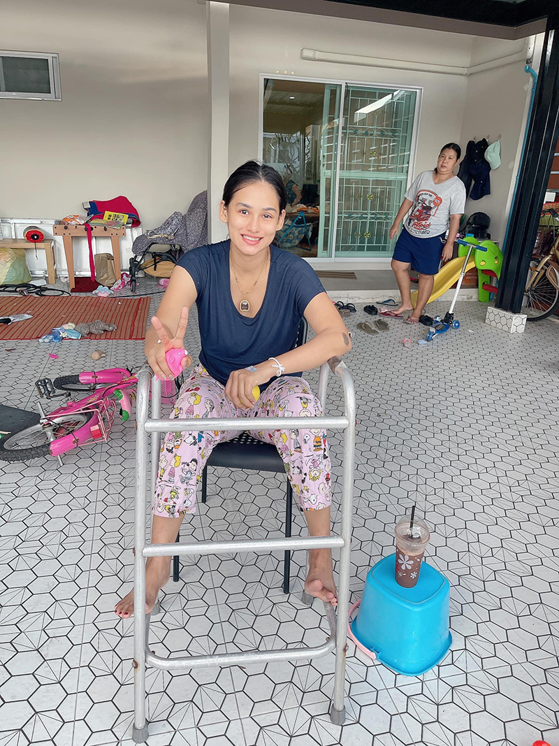 สาวแชร์ประสบการณ์ เส้นเลือดในสมองตีบ